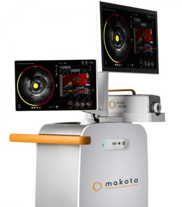 Makoto Intravascular Imaging System